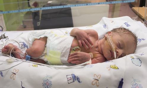 Baby in incubator image